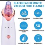 Blackhead-Machine-1.jpg